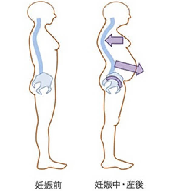 妊娠前と妊娠中・産後の姿勢の比較